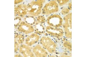 Immunohistochemistry of paraffin-embedded human kidney using CALCOCO1 antibody at dilution of 1:100 (40x lens).