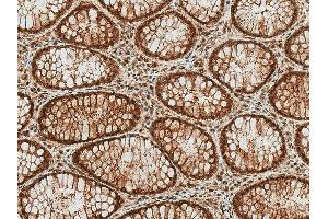 Immunohistochemistry analysis using Rabbit Anti-HSP70 (Acetyl Lys77) Polyclonal Antibody (ABIN5650771). (HSP70 antibody  (acLys77) (HRP))