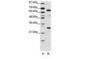 Image no. 1 for anti-High Mobility Group Box 4 (HMGB4) (C-Term) antibody (ABIN6736129) (HMGB4 antibody  (C-Term))