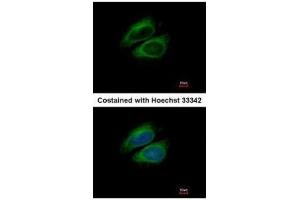 ICC/IF Image Immunofluorescence analysis of methanol-fixed HeLa, using CSDE1, antibody at 1:200 dilution. (CDSE1 antibody  (Internal Region))