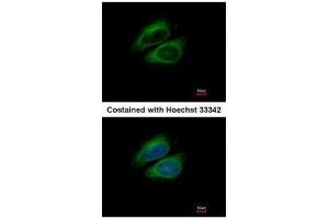 ICC/IF Image Immunofluorescence analysis of methanol-fixed HeLa, using CSDE1, antibody at 1:200 dilution. (CDSE1 antibody  (Internal Region))