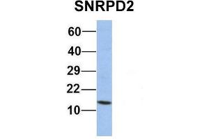 Host:  Rabbit  Target Name:  SNRPD2  Sample Type:  Human Jurkat  Antibody Dilution:  1. (SNRPD2 antibody  (Middle Region))