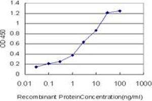 Detection limit for recombinant GST tagged SIRT1 is approximately 0. (SIRT1 antibody  (AA 456-555))