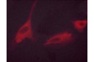 Immunofluorescence (fixed cells) (IF/ICC) image for anti-Ribosomal Protein S6 Kinase, 70kDa, Polypeptide 1 (RPS6KB1) (pThr389), (pThr412) antibody (ABIN6256559)
