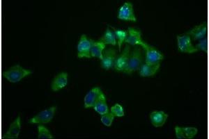 Immunofluorescence staining of Hela cells with ABIN7127637 at 1:23, counter-stained with DAPI. (Recombinant NDRG1 antibody)