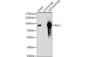 Immunoprecipitation analysis of 200 μg extracts of 293T cells, using 3 μg Ezrinin antibody (ABIN6129377, ABIN6140400, ABIN6140401 and ABIN6213959). (Ezrin antibody  (AA 350-470))