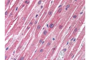 Image no. 1 for anti-Tuberous Sclerosis 1 (TSC1) antibody (ABIN302894) (TSC1 antibody)
