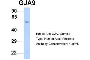 Host: Rabbit Target Name: GJA9 Sample Type: Human Adult Placenta Antibody Dilution: 1. (GJA9 antibody  (Middle Region))