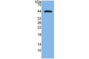 WB of Protein Standard: different control antibodies against Highly purified E. (GOT1 ELISA Kit)
