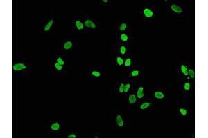 Immunofluorescence staining of Hela cells(treated by 15 mM sodium butyrate for 30 min) with ABIN7127271 at 1:65,counter-stained with DAPI. (Recombinant HIST1H4A antibody  (acLys56))
