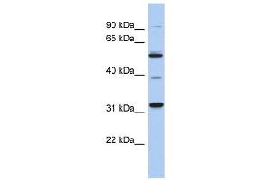MGC51025 antibody used at 1 ug/ml to detect target protein.