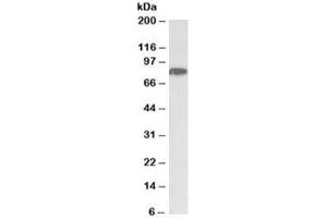 Western blot testing of HeLa nuclear lysate with CHUK antibody at 1ug/ml. (IKK alpha antibody)
