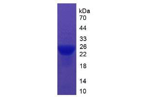 SDS-PAGE analysis of Mouse ITIH5 Protein. (ITIH5 Protein)