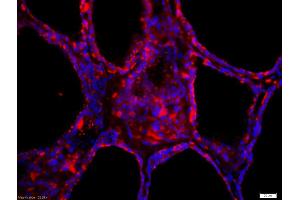 Formalin-fixed and paraffin-embedded human thyroid labeled with Anti-Thyroid peroxidase Polyclonal Antibody, Unconjugated (ABIN668736) 1:200, overnight at 4°C, The secondary antibody was Goat Anti-Rabbit IgG, Cy3 conjugated used at 1:200 dilution for 40 minutes at 37°C. (Thyroperoxidase antibody  (AA 351-450))