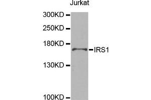 Western blot analysis of extracts of Jurkat cell lines, using IRS1 antibody. (IRS1 antibody)