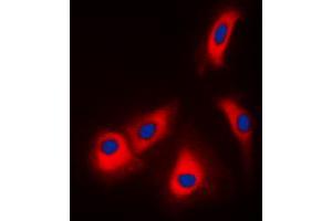 Immunofluorescent analysis of Adenosine Kinase staining in HepG2 cells. (ADK antibody  (N-Term))