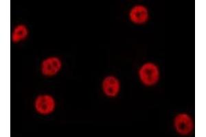 ABIN6277712 staining Hela by IF/ICC. (TP53BP1 antibody  (N-Term))