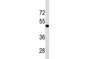 TGFBR1 antibody western blot analysis in human HL-60 lysate. (TGFBR1 antibody  (AA 145-172))