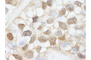 Immunohistochemistry (IHC) image for anti-Histone Deacetylase 7 (HDAC7) (AA 902-952) antibody (ABIN7448594) (HDAC7 antibody  (AA 902-952))