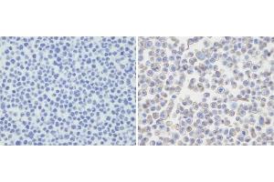 Immunohistochemical analysis of PDL-2 in untransfected(left) or transfected(right) with 293T cell sections. (PDCD1LG2 antibody  (N-Term))