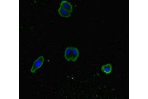 Immunofluorescent analysis of HepG2 cells using ABIN7170352 at dilution of 1:100 and Alexa Fluor 488-congugated AffiniPure Goat Anti-Rabbit IgG(H+L) (SNX14 antibody  (AA 601-893))