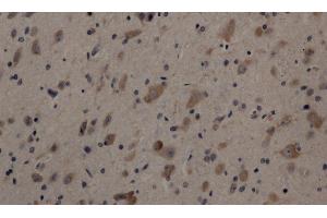 Immunohistochemistry of paraffin-embedded Rat brain using Cleaved-NOTCH1 (V1754) Polyclonal Antibody at dilution of 1:200 (Notch1 antibody  (Cleaved-Val1754))