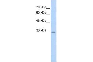 Western Blotting (WB) image for anti-Chromosome 6 Open Reading Frame 134 (C6orf134) antibody (ABIN2462612) (Chromosome 6 Open Reading Frame 134 (C6orf134) antibody)