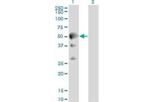 Western Blot analysis of SEPT10 expression in transfected 293T cell line by SEPT10 monoclonal antibody (M01), clone 2A12. (Septin 10 antibody  (AA 1-454))
