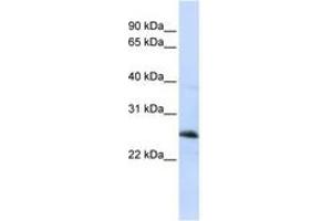 Image no. 1 for anti-Reticulon 1 (RTN1) (C-Term) antibody (ABIN6741063)