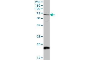 CAMKK2 MaxPab rabbit polyclonal antibody. (CAMKK2 antibody  (AA 1-541))