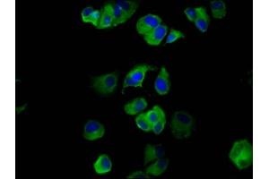 Immunofluorescence staining of MCF-7 cells with ABIN7160831 at 1:133, counter-stained with DAPI.