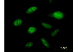 Immunofluorescence of purified MaxPab antibody to DDX50 on HeLa cell.