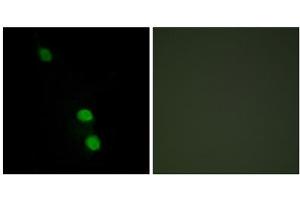 Immunofluorescence analysis of HepG2 cells, using TEAD2 antibody. (TEAD2 antibody  (Internal Region))