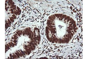 Image no. 7 for anti-THUMP Domain Containing 1 (THUMPD1) antibody (ABIN1501384) (THUMPD1 antibody)