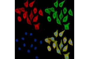 ABIN7095626 and ABIN7099688 staining Hela cells by IF/ICC.