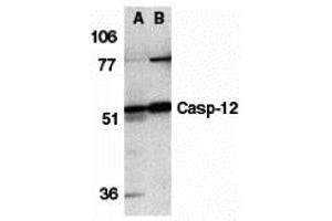Western Blotting (WB) image for anti-Caspase 12 (Gene/pseudogene) (CASP12) (N-Term) antibody (ABIN1031295) (Caspase 12 antibody  (N-Term))