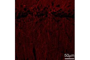 Immunohistochemistry (IHC) image for anti-gamma-aminobutyric Acid (GABA) A Receptor, beta 2 (GABRB2) (AA 343-430) antibody (ABIN1742467)
