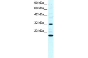 Western Blotting (WB) image for anti-rho GDP Dissociation Inhibitor (GDI) gamma (ARHGDIG) antibody (ABIN2460825) (ARHGDIG antibody)