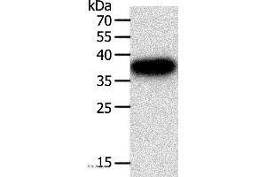 Western blot analysis of A549 cell, using PLAUR Polyclonal Antibody at dilution of 1:400