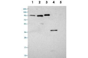 Western blot analysis of Lane 1: RT-4, Lane 2: U-251 MG, Lane 3: Human Plasma, Lane 4: Liver, Lane 5: Tonsil with CCDC19 polyclonal antibody  at 1:100-1:250 dilution. (CCDC19 antibody)