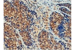 Immunohistochemistry (Paraffin-embedded Sections) (IHC (p)) image for anti-Tripartite Motif Containing 24 (TRIM24) (C-Term) antibody (ABIN1109252)