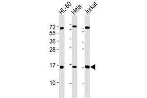 Western Blotting (WB) image for anti-Small Ubiquitin Related Modifier Protein 1 (SUMO1) antibody (ABIN3032642)