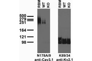Immunoblot of crude brain membranes from adult rat (RBM) and Cav3. (Cav3.1 Ca2+ Channel (AA 2052-2172), (C-Term), (Cytosolic) antibody)