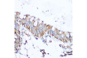 Immunohistochemistry of paraffin-embedded human colon using SIRT4 Rabbit pAb (ABIN6129330, ABIN6147796, ABIN6147797 and ABIN6223494) at dilution of 1:100 (40x lens). (SIRT4 antibody  (AA 29-260))
