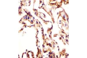 Antibody staining AOC3 in human lung tissue sections by Immunohistochemistry (IHC-P - paraformaldehyde-fixed, paraffin-embedded sections). (AOC3 antibody  (AA 613-640))