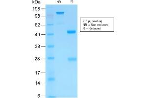 SDS-PAGE Analysis of Purified MMP3 Rabbit Recombinant Monoclonal Antibody (MMP3/1994R). (Recombinant MMP3 antibody  (AA 317-327))