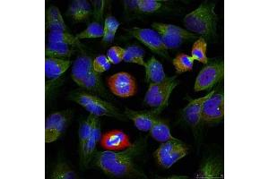 Immunofluorescence staining of methanol-fixed HeLa cells using BCL-XL (phospho-Ser62) antibody. (BCL2L1 antibody  (pSer62))
