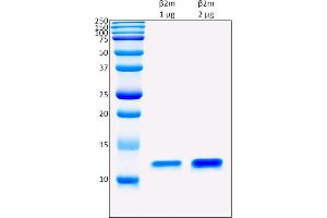 SDS-PAGE (SDS) image for beta-2-Microglobulin (B2M) protein (ABIN5675808) (beta-2 Microglobulin Protein)