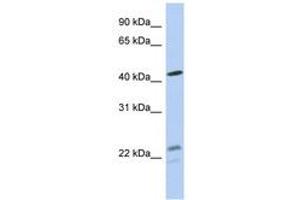 Image no. 1 for anti-Branched Chain Keto Acid Dehydrogenase E1, alpha Polypeptide (BCKDHA) (AA 71-120) antibody (ABIN6743978) (BCKDHA antibody  (AA 71-120))