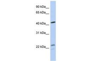 Image no. 1 for anti-Branched Chain Keto Acid Dehydrogenase E1, alpha Polypeptide (BCKDHA) (AA 71-120) antibody (ABIN6743978)